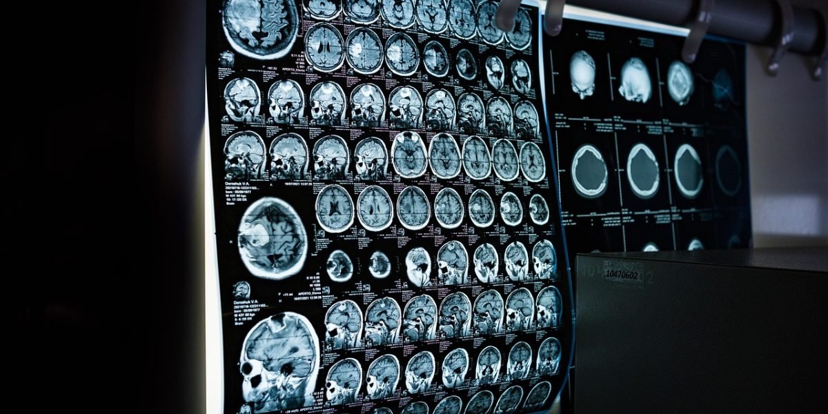 Medical professionals collaborating to understand complex biological responses to chronic stress and burnout.